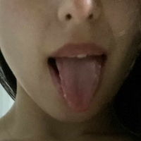 адора_18 Голе