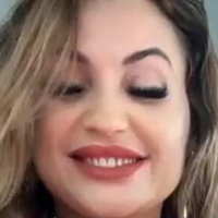 Велике Лабије Девојке Голе