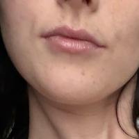 Харли / Блејрррр Голе