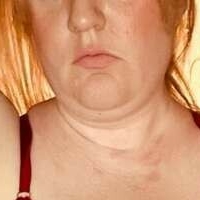 Хејзел Ајрис Голе