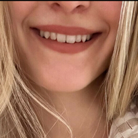 Хани Емс Голе