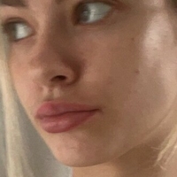 лолајслaки Голе