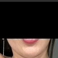 Мелина Итхуррат Голе