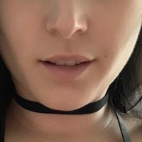 Нисевајдхофер Голе