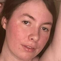 Ноаникс Фри Голе