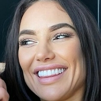 Шања Перет Голе