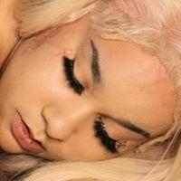 зефориназија Голе