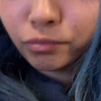 Јуразнгф Голе